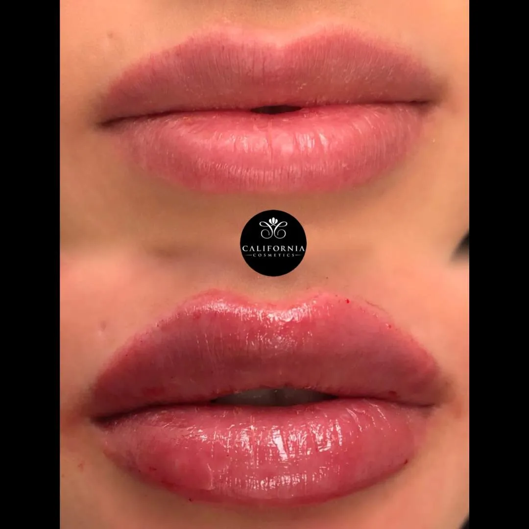 Kissable Lips Package