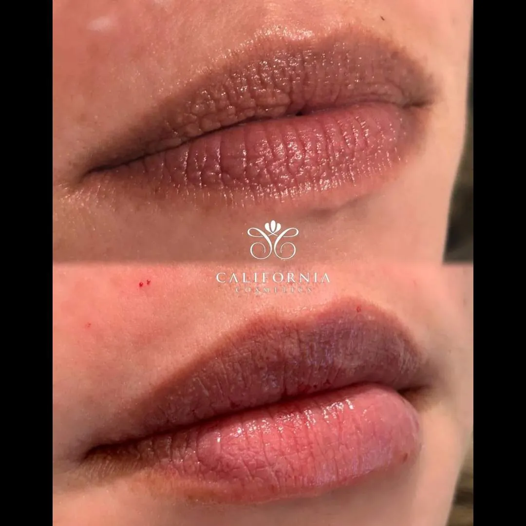 Kissable Lips Package