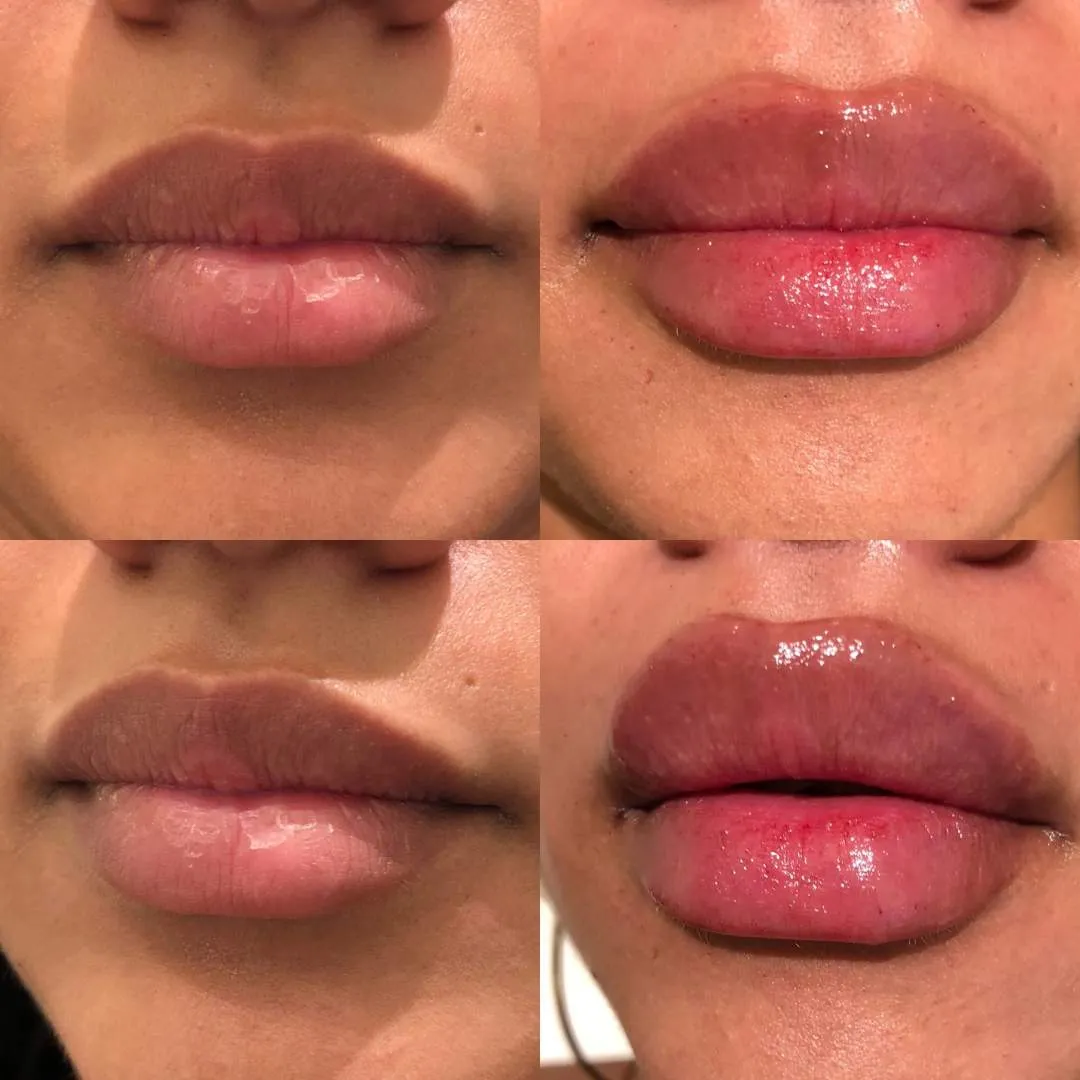 Kissable Lips Package