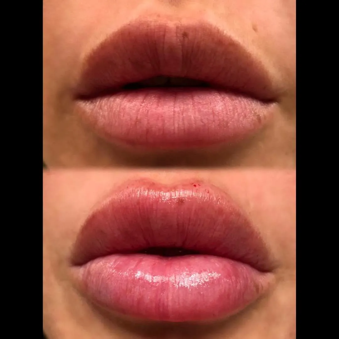 Kissable Lips Package