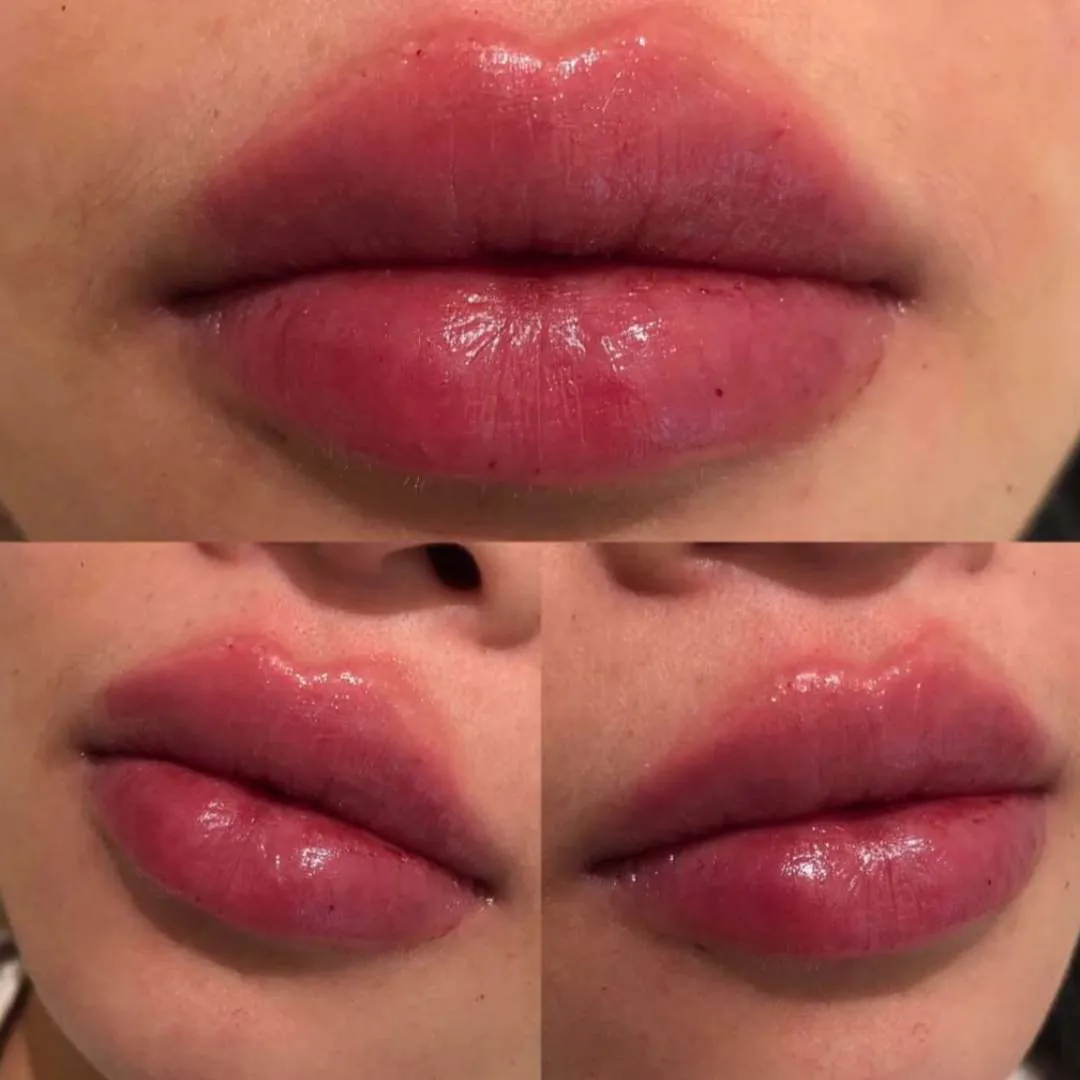 Kissable Lips Package