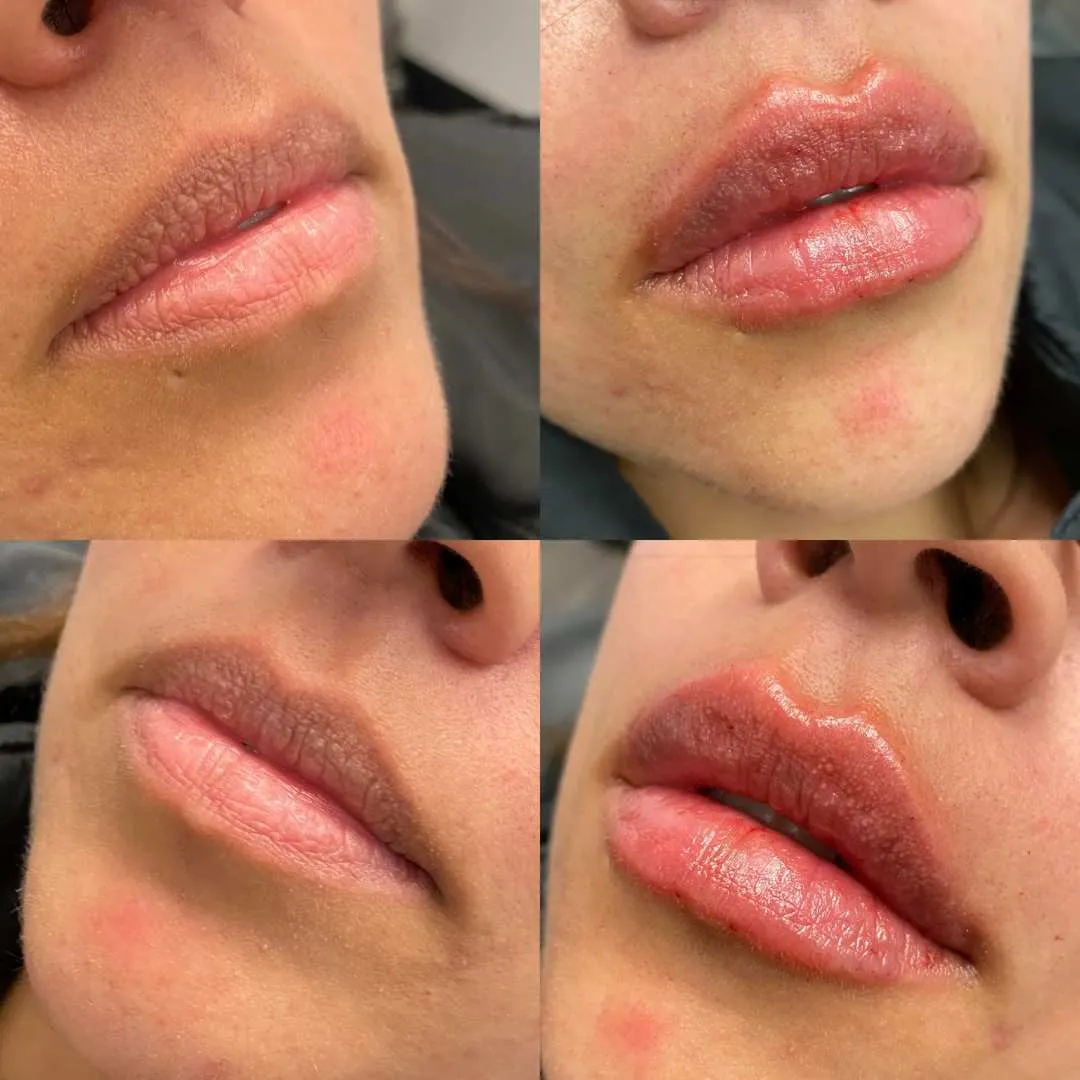 Kissable Lips Package