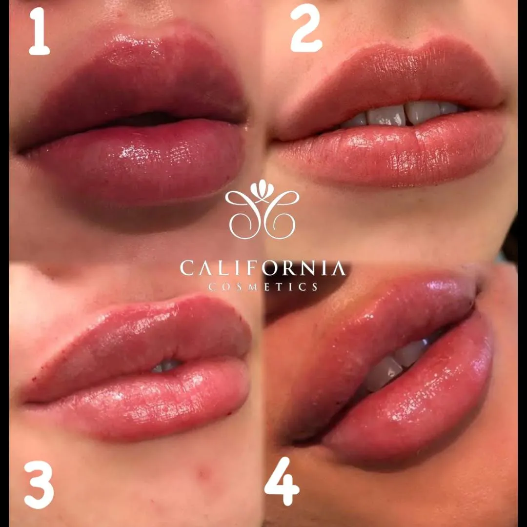 Kissable Lips Package