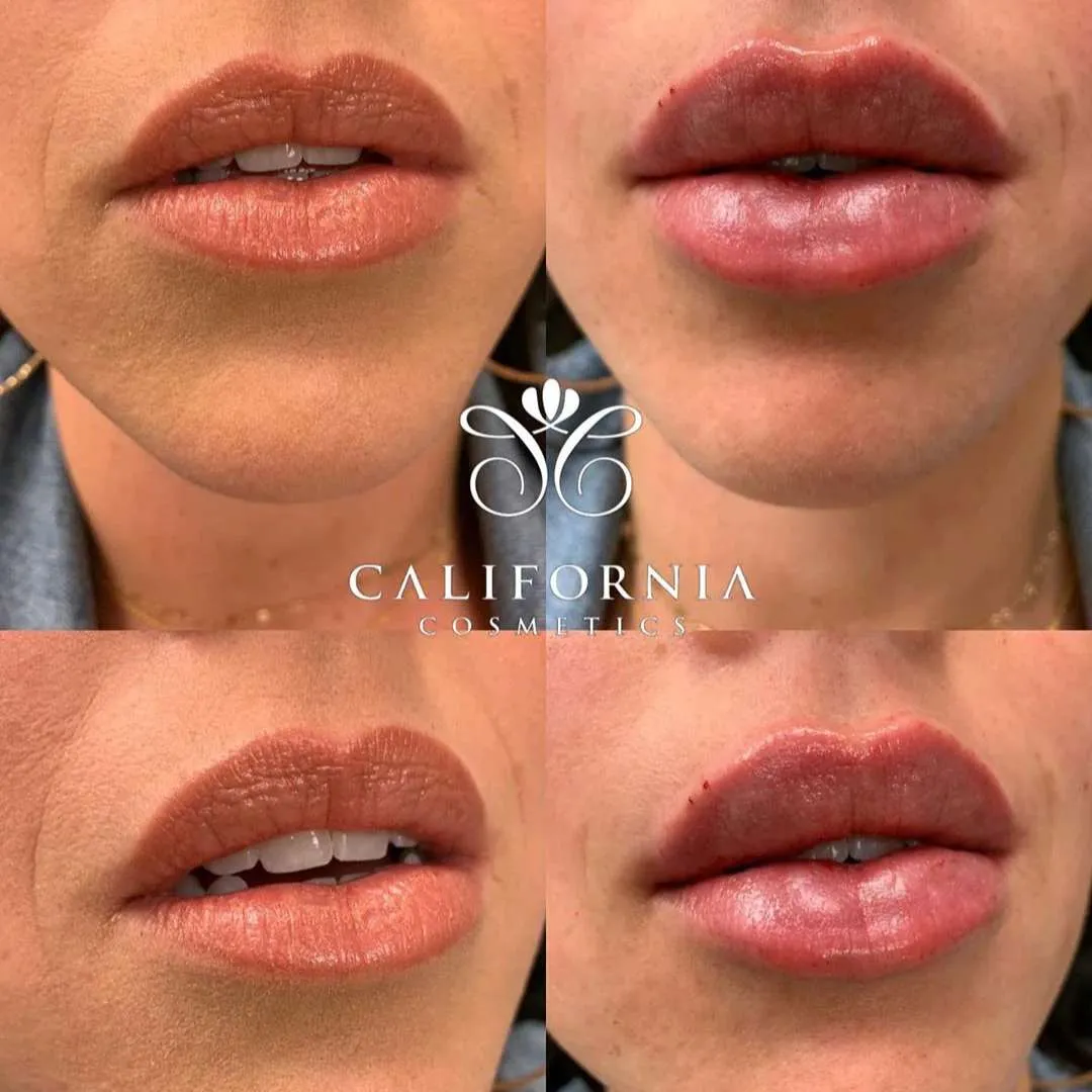 Kissable Lips Package