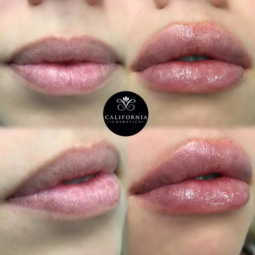 Kissable Lips Package