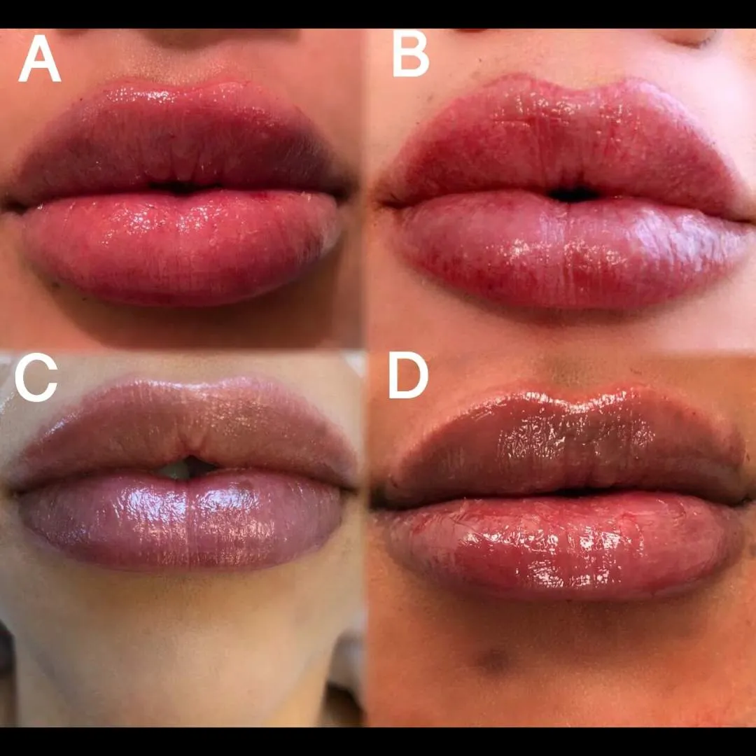 Kissable Lips Package