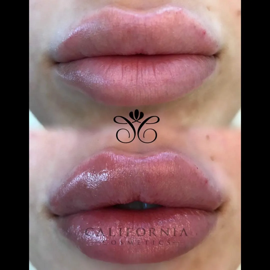 Kissable Lips Package