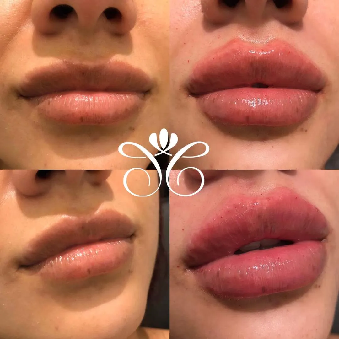 Kissable Lips Package