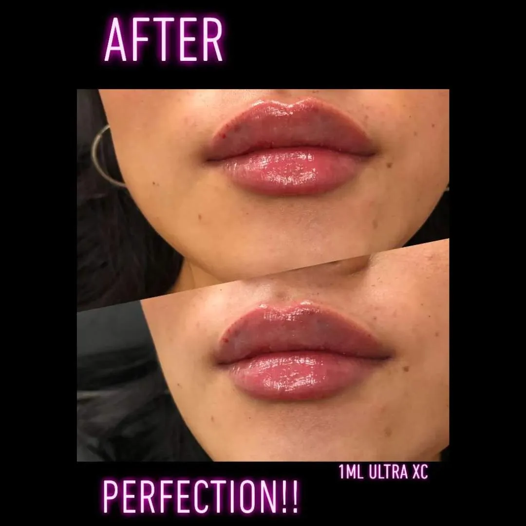 Kissable Lips Package