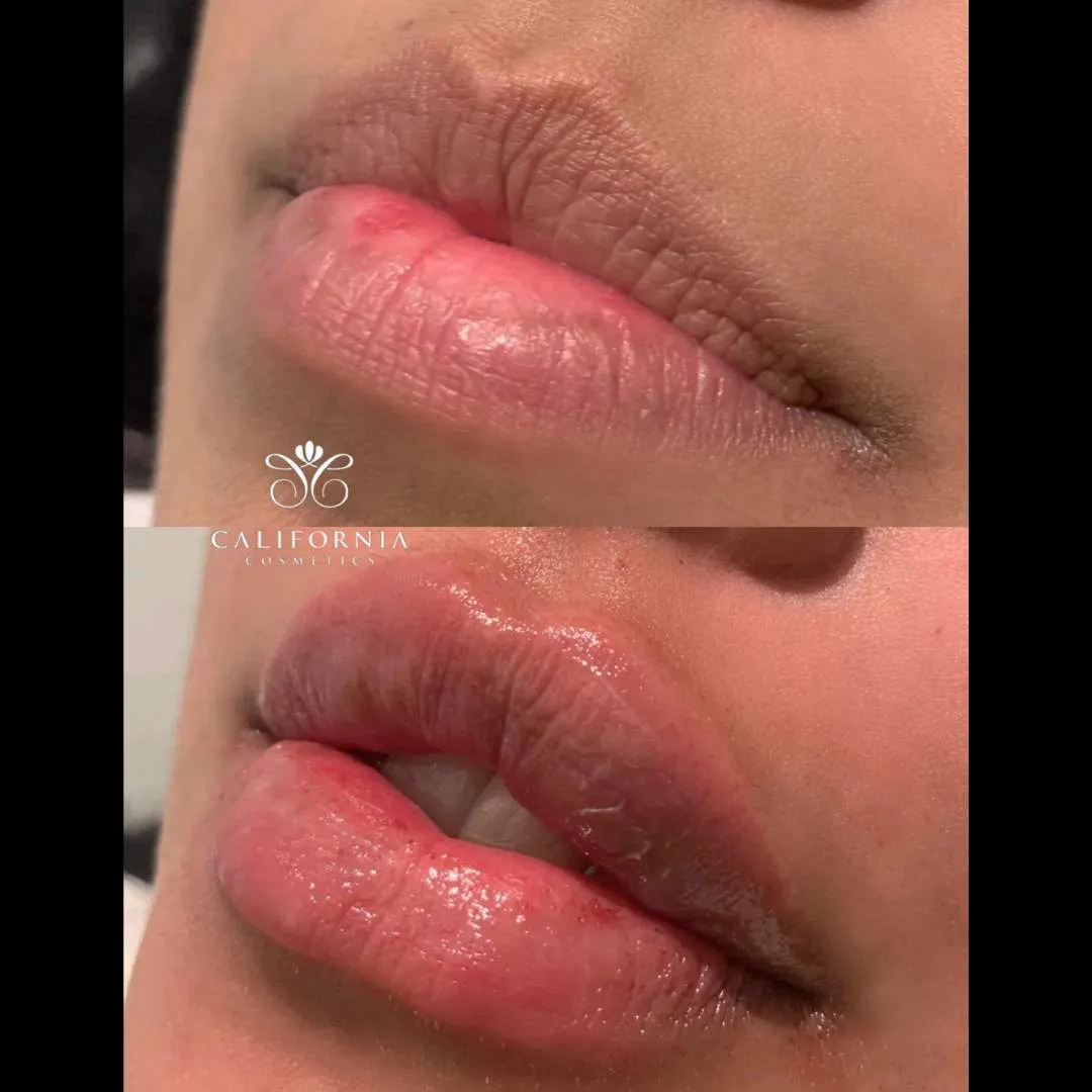 Kissable Lips Package