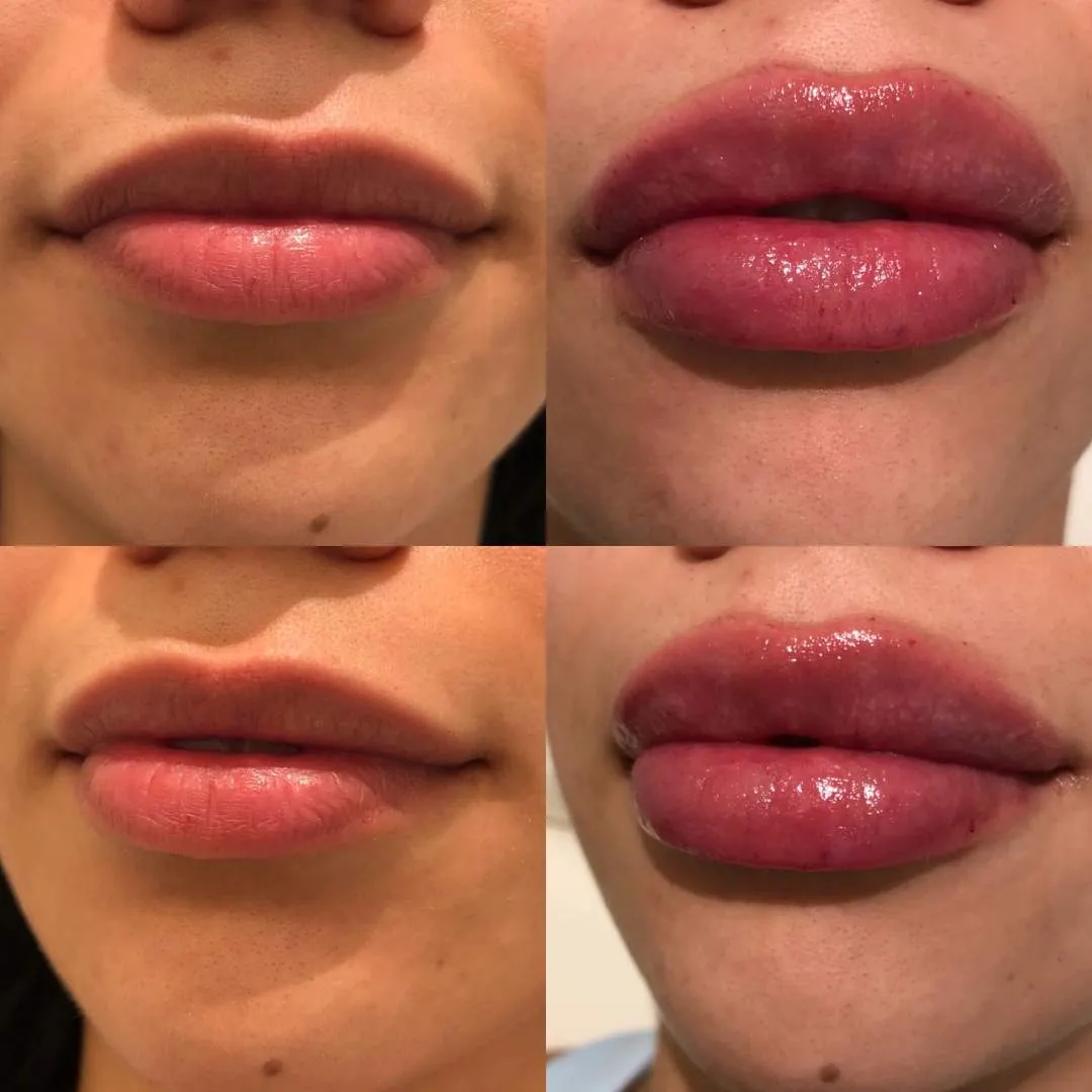 Kissable Lips Package