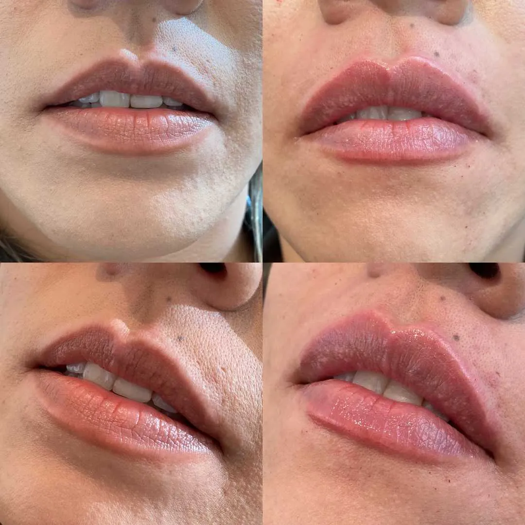 Kissable Lips Package