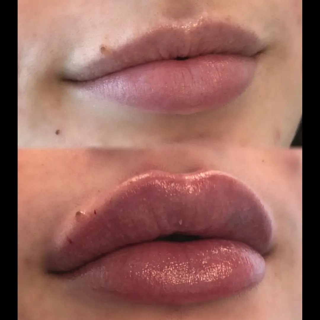 Kissable Lips Package