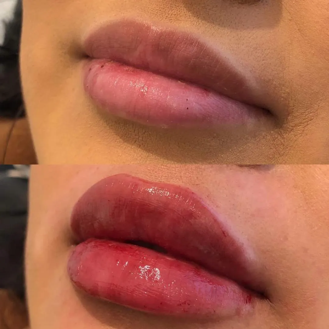 Kissable Lips Package