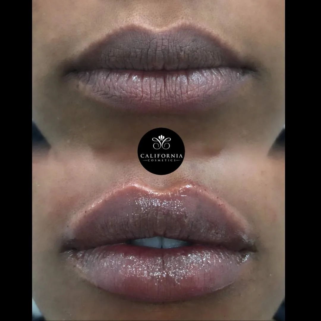 Kissable Lips Package