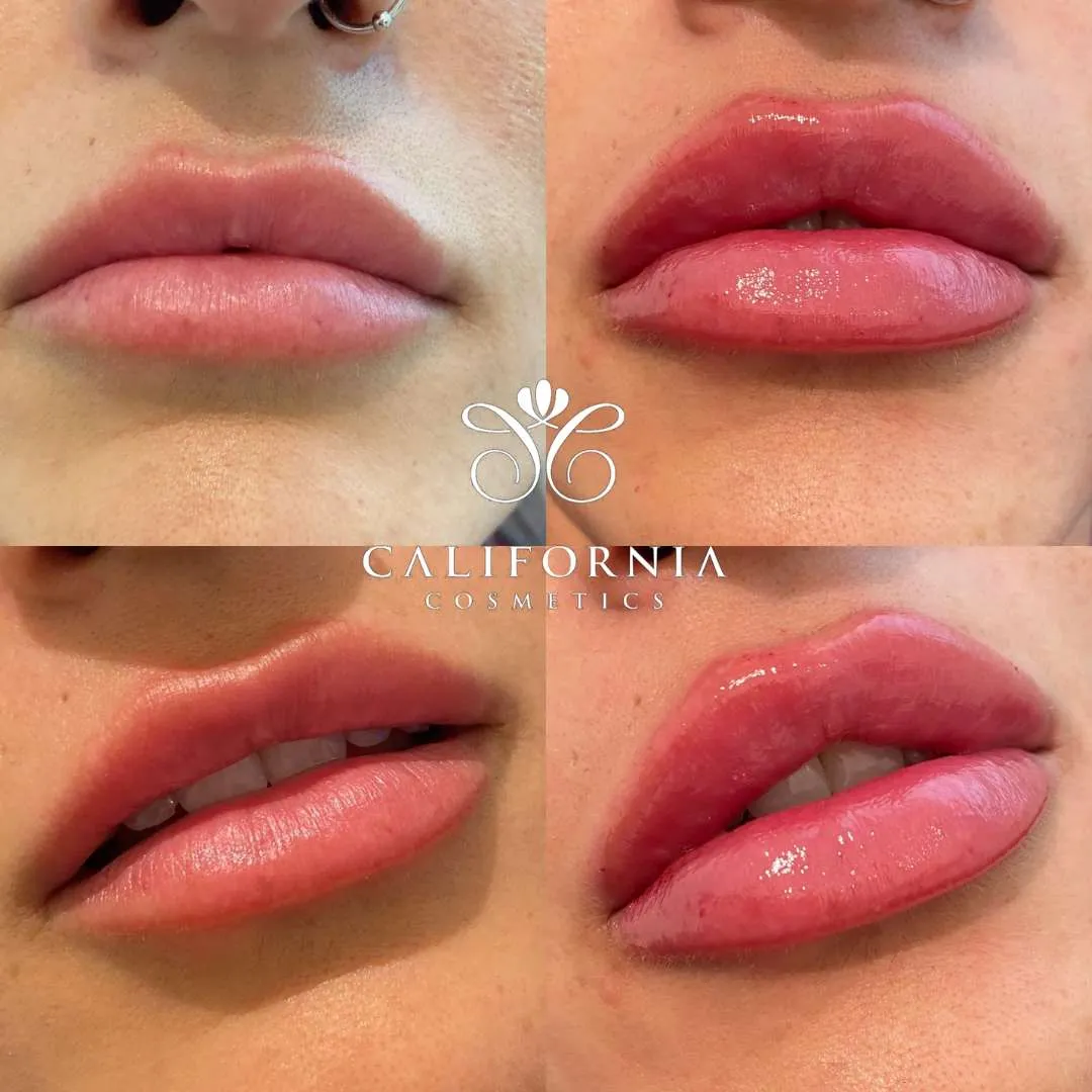 Kissable Lips Package