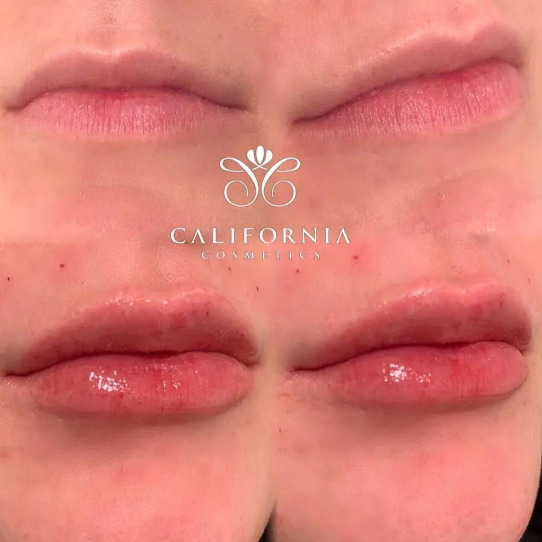 Kissable Lips Package