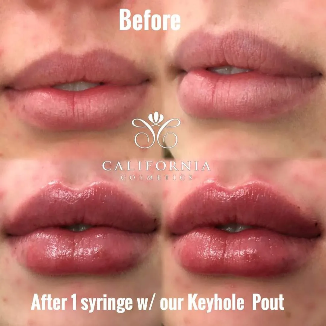 Kissable Lips Package