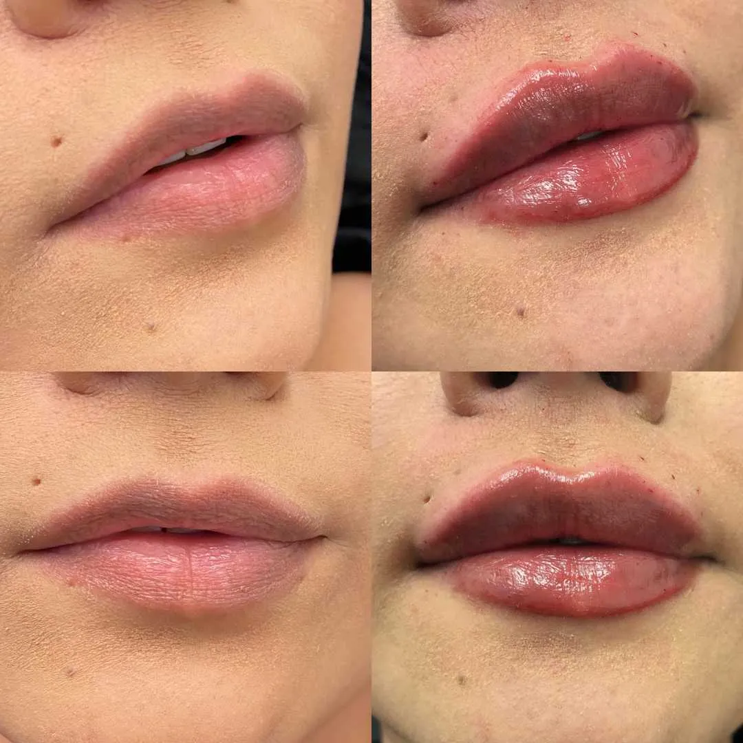 Kissable Lips Package