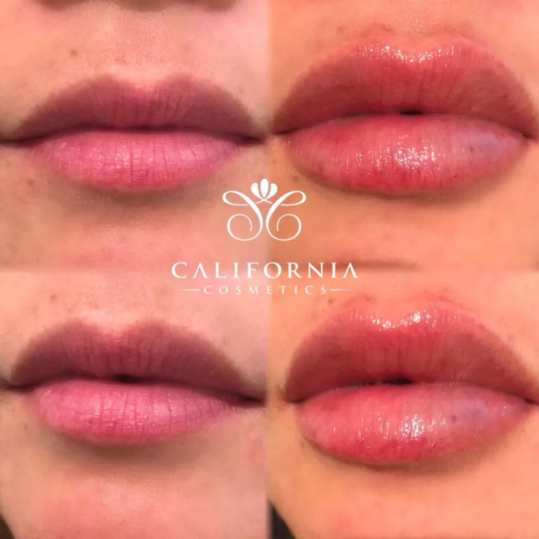 Kissable Lips Package