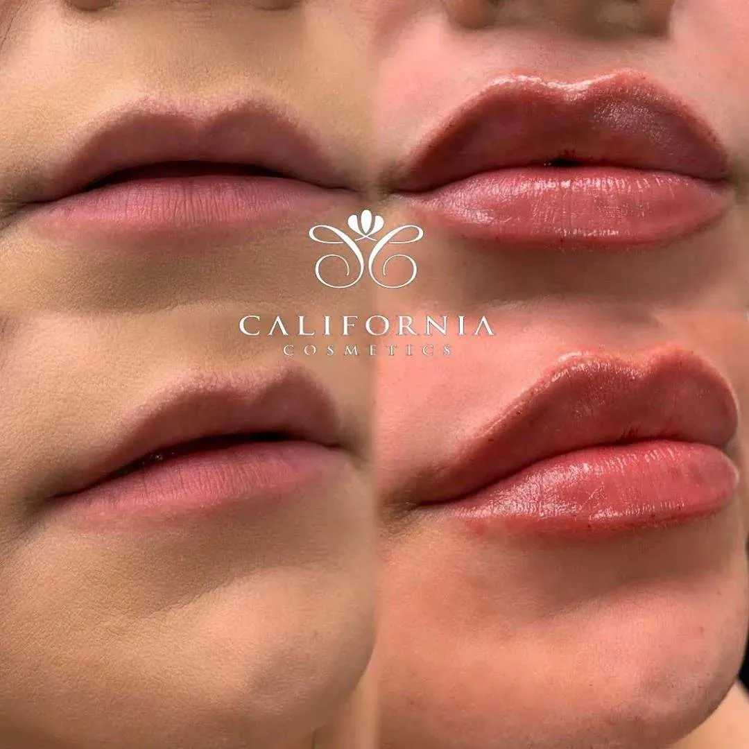 Kissable Lips Package